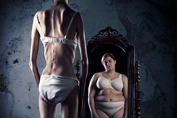 anorexia